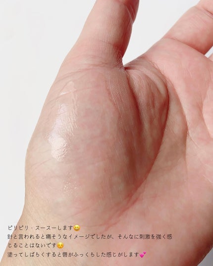 キューミ―ボムショットリッププランパー/AGARISM/リッププランパーを使ったクチコミ(4枚目)