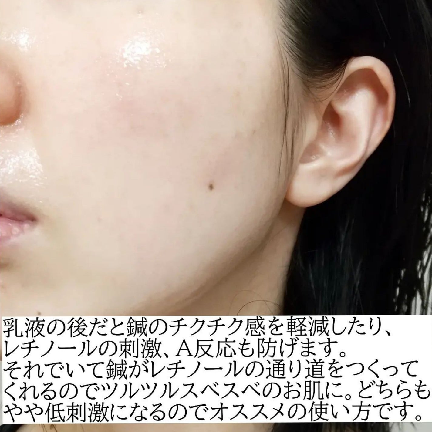 マイルドリードルショット50/VT/美容液を使ったクチコミ(6枚目)