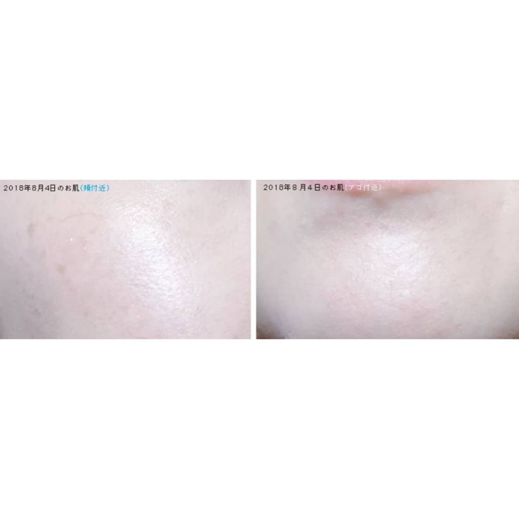 アクネスラボ 薬用 ウォッシングフォームのクチコミ「【ACNES LABO】

☑ウォッシングフォーム
＜150mL / 1,478円(Amazo.....」（3枚目）