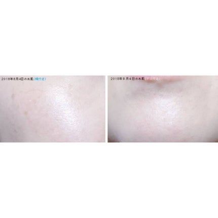 薬用 ウォッシングフォーム/アクネスラボ/洗顔フォームを使ったクチコミ(3枚目)