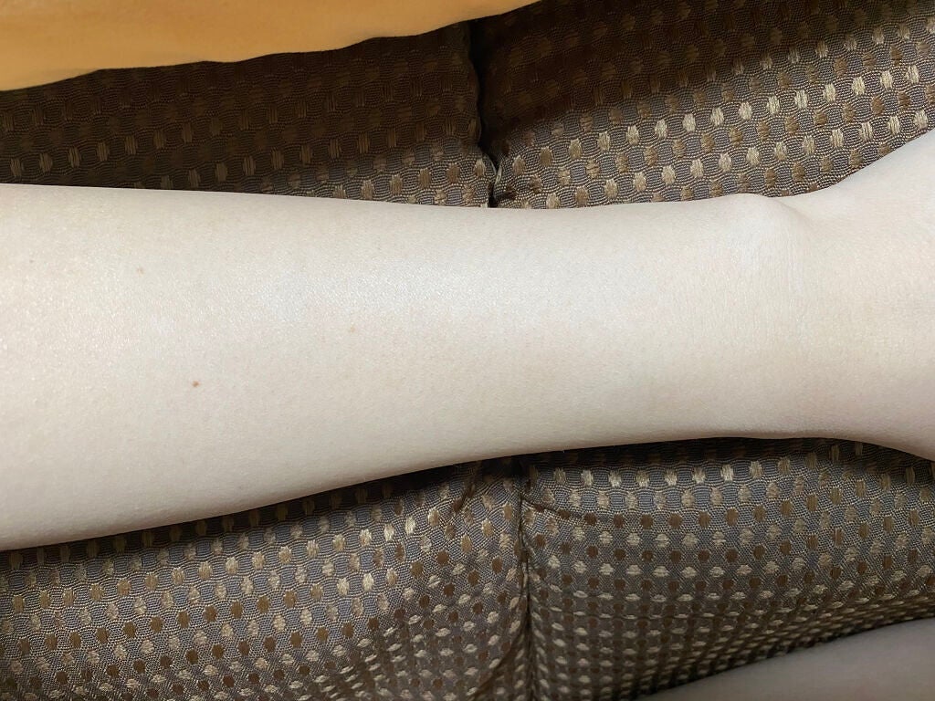 アイスレディ/icelady/家庭用脱毛器を使ったクチコミ(7枚目)