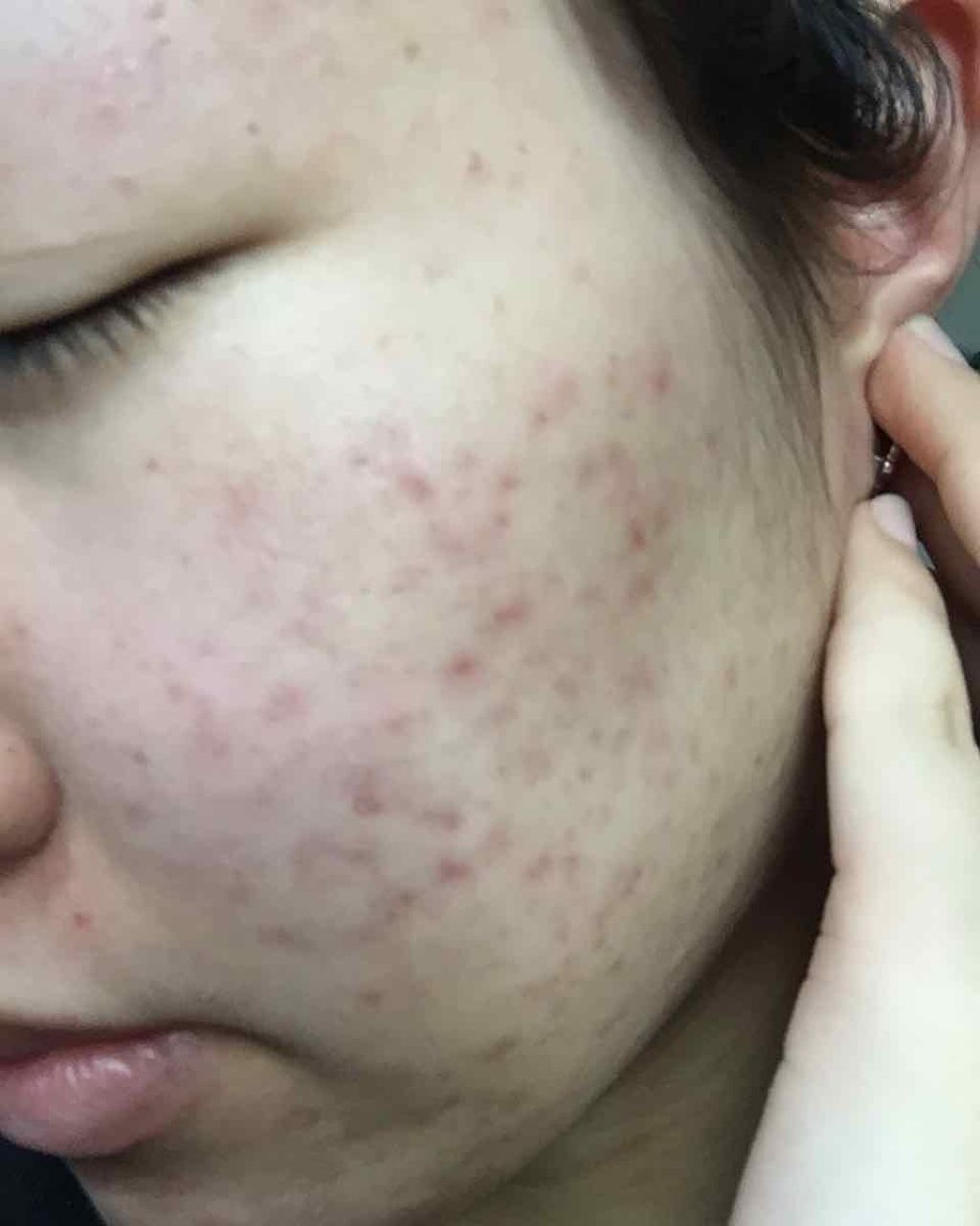 SP クッション ウルトラカバークッション BB/MAYBELLINE NEW YORK/クッションファンデーションを使ったクチコミ(1枚目)