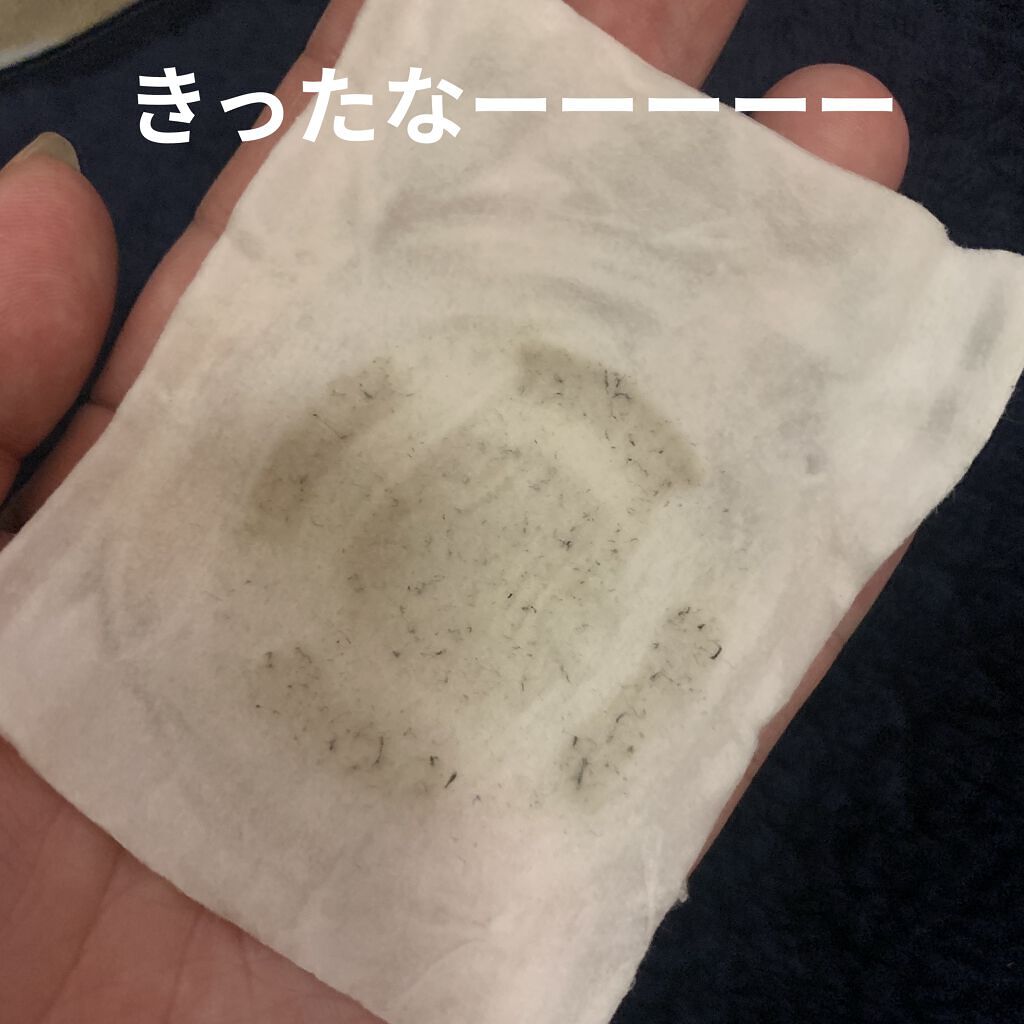 多機能温冷美顔器/ANLAN/美顔器・マッサージを使ったクチコミ（3枚目）