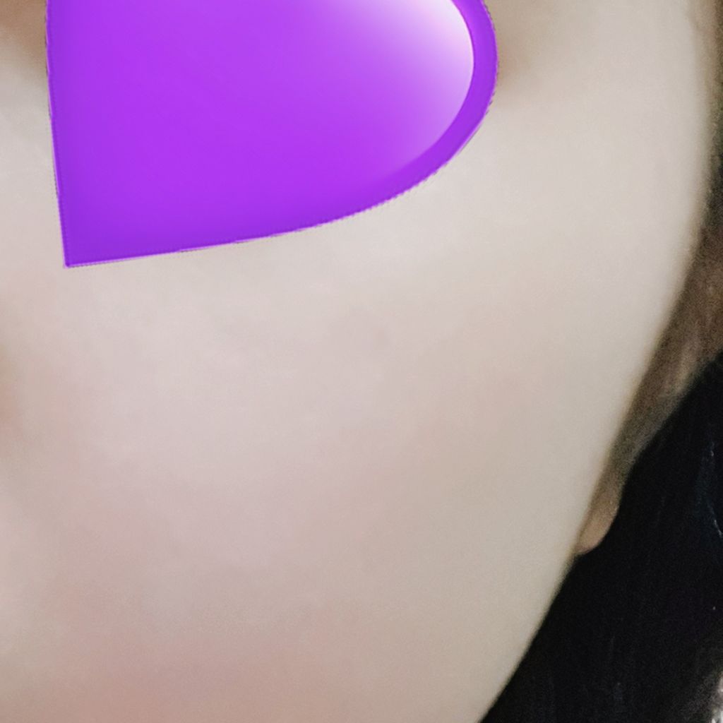 オードムーゲ 薬用ローション（ふきとり化粧水）/オードムーゲ/拭き取り化粧水を使ったクチコミ（2枚目）