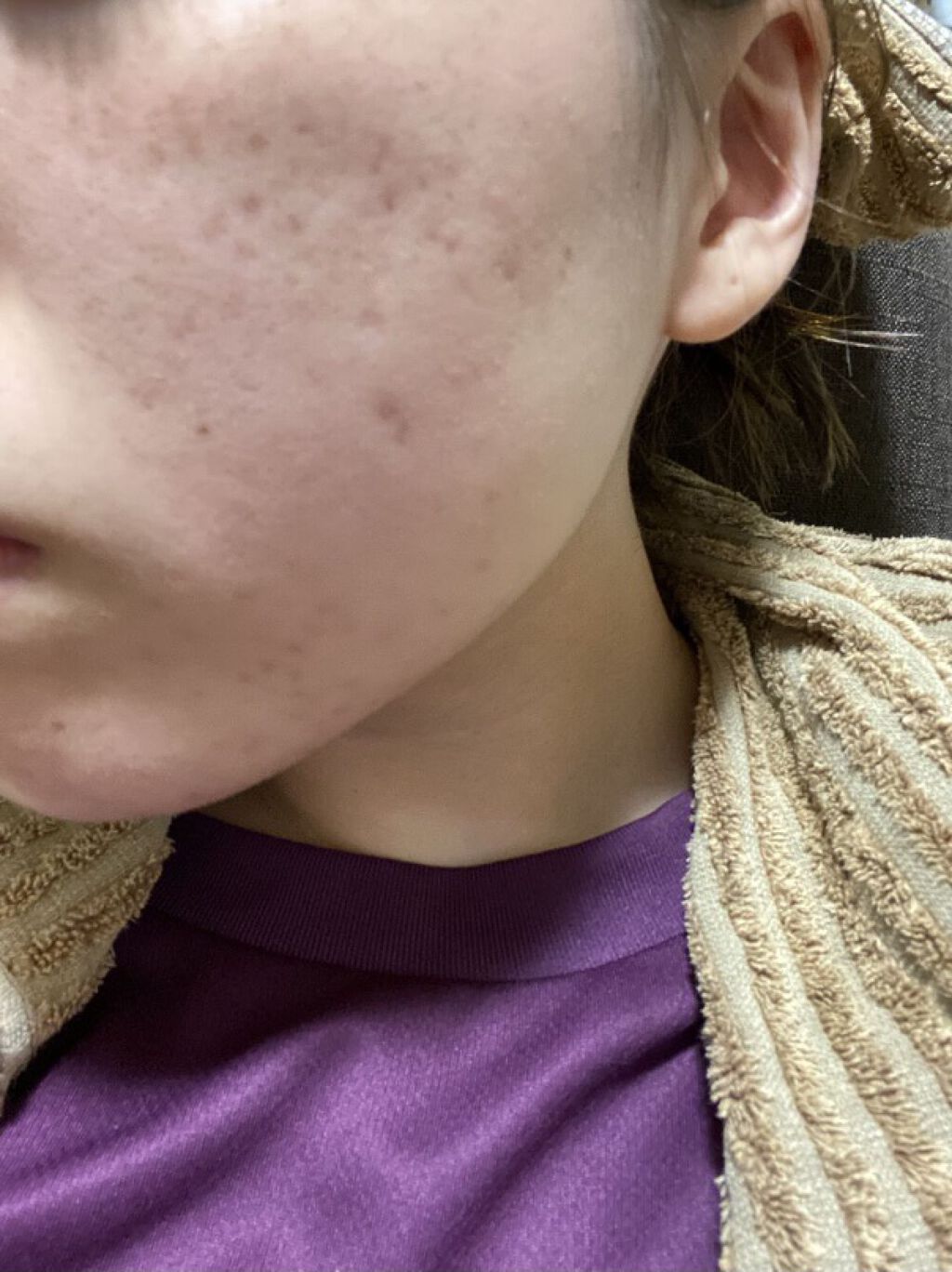 ホワイトニング ミスト セラム/アルージェ/ミスト状化粧水を使ったクチコミ（3枚目）