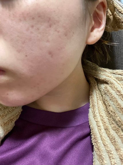 フレッシュリージュースドビタミンドロップ(35ml)/Klairs/美容液を使ったクチコミ(3枚目)