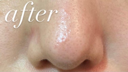 ノーモアブラックヘッド(ノーズピーリング)/One-day's you/スクラブ・ゴマージュを使ったクチコミ(3枚目)