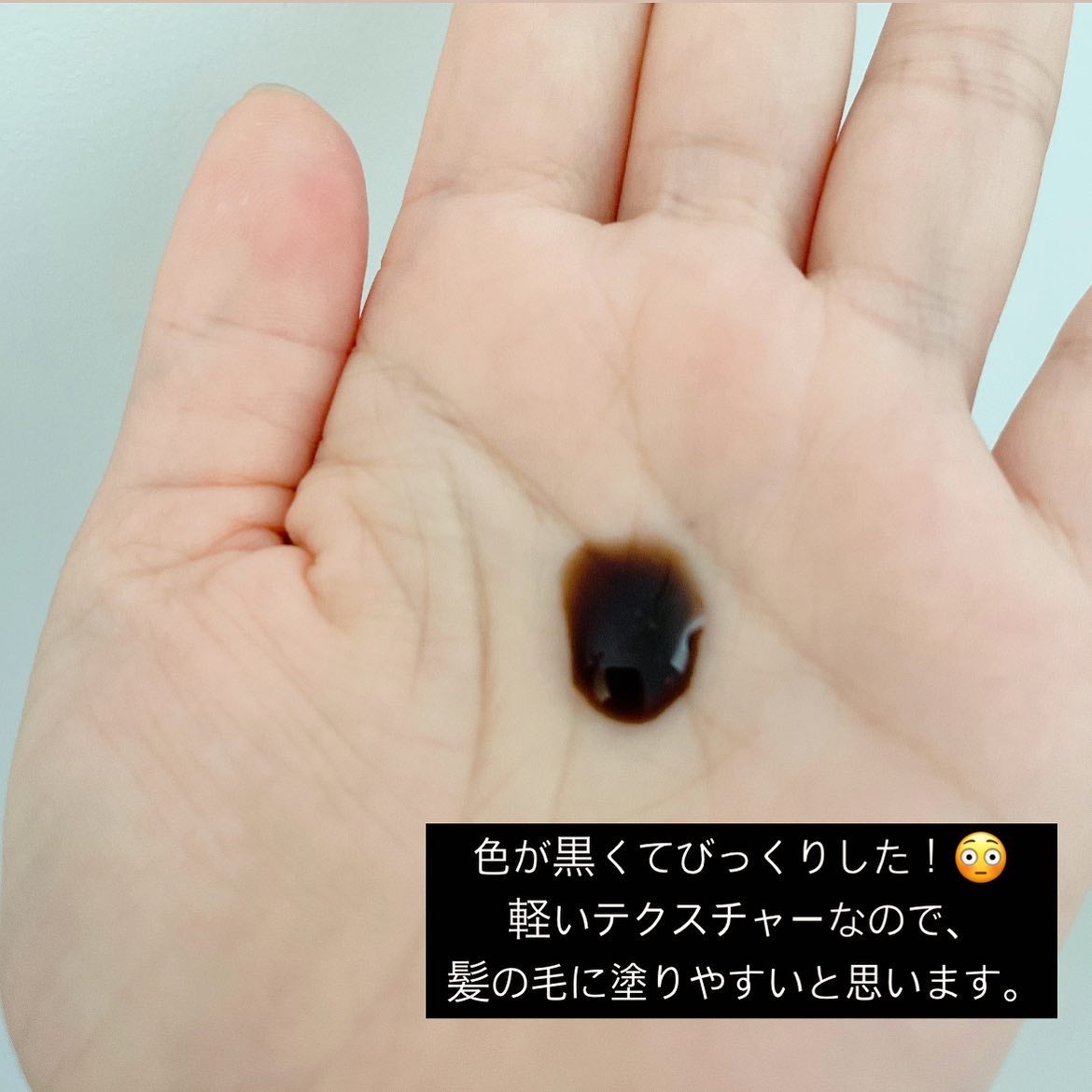 プロヘマチン原液 ヒト幹細胞培養エキス+/fracora/洗い流すヘアトリートメントを使ったクチコミ(3枚目)