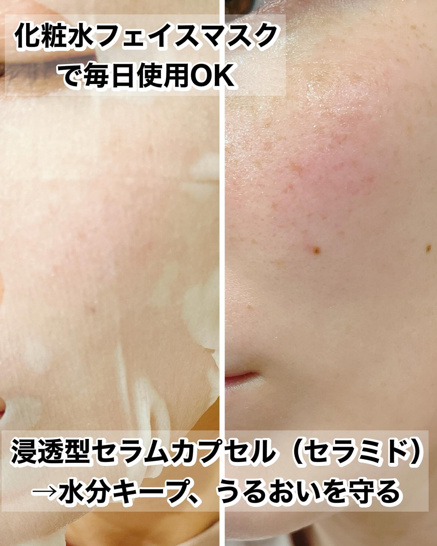 れいこ❤️ on LIPS 「ルルルン様から提供いただきました💚ルルルンプレシャスGREEN..」(3枚目)