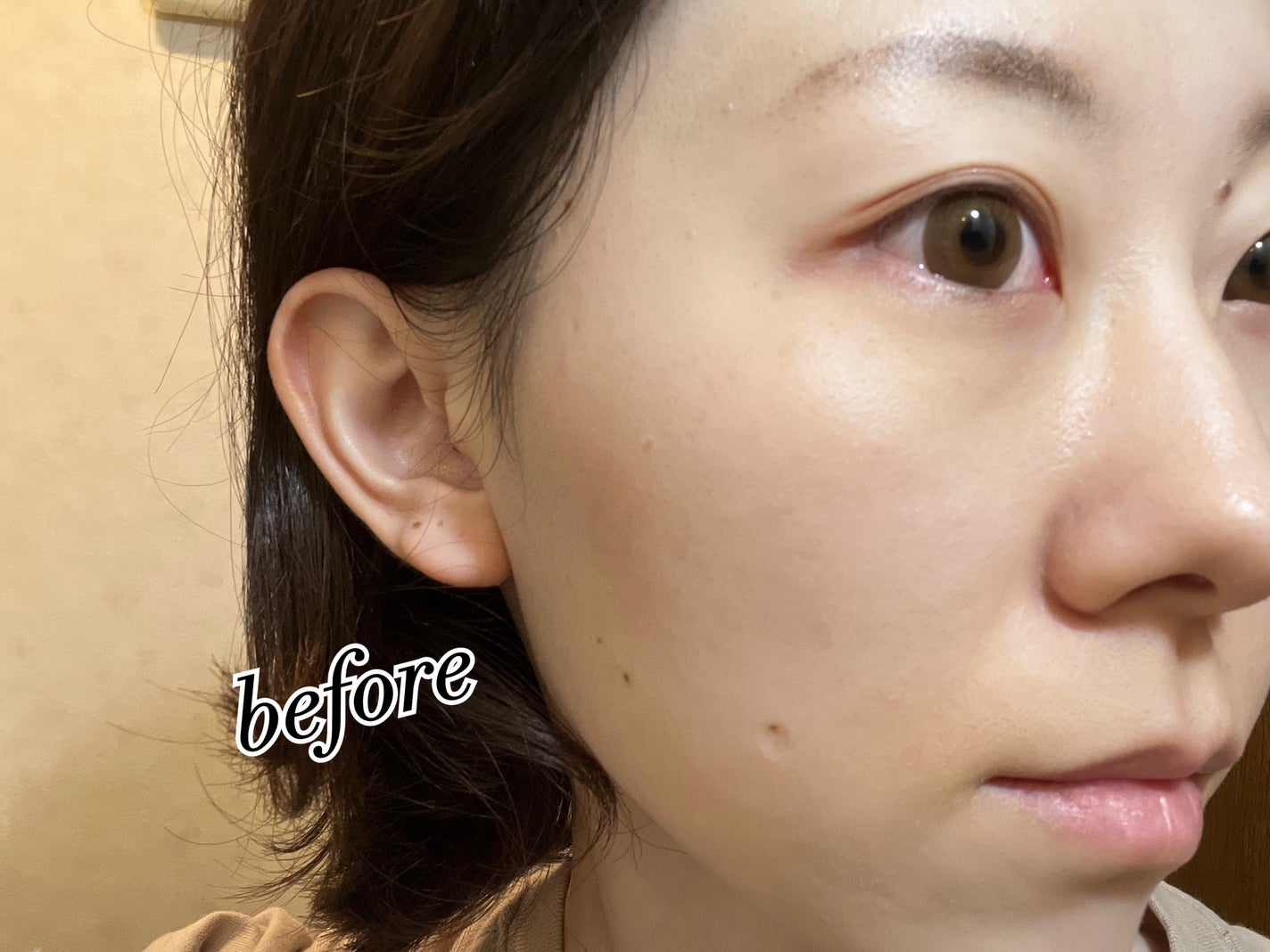 ビタバランスジェルクレンジング/.akaran/クレンジングジェルを使ったクチコミ(6枚目)