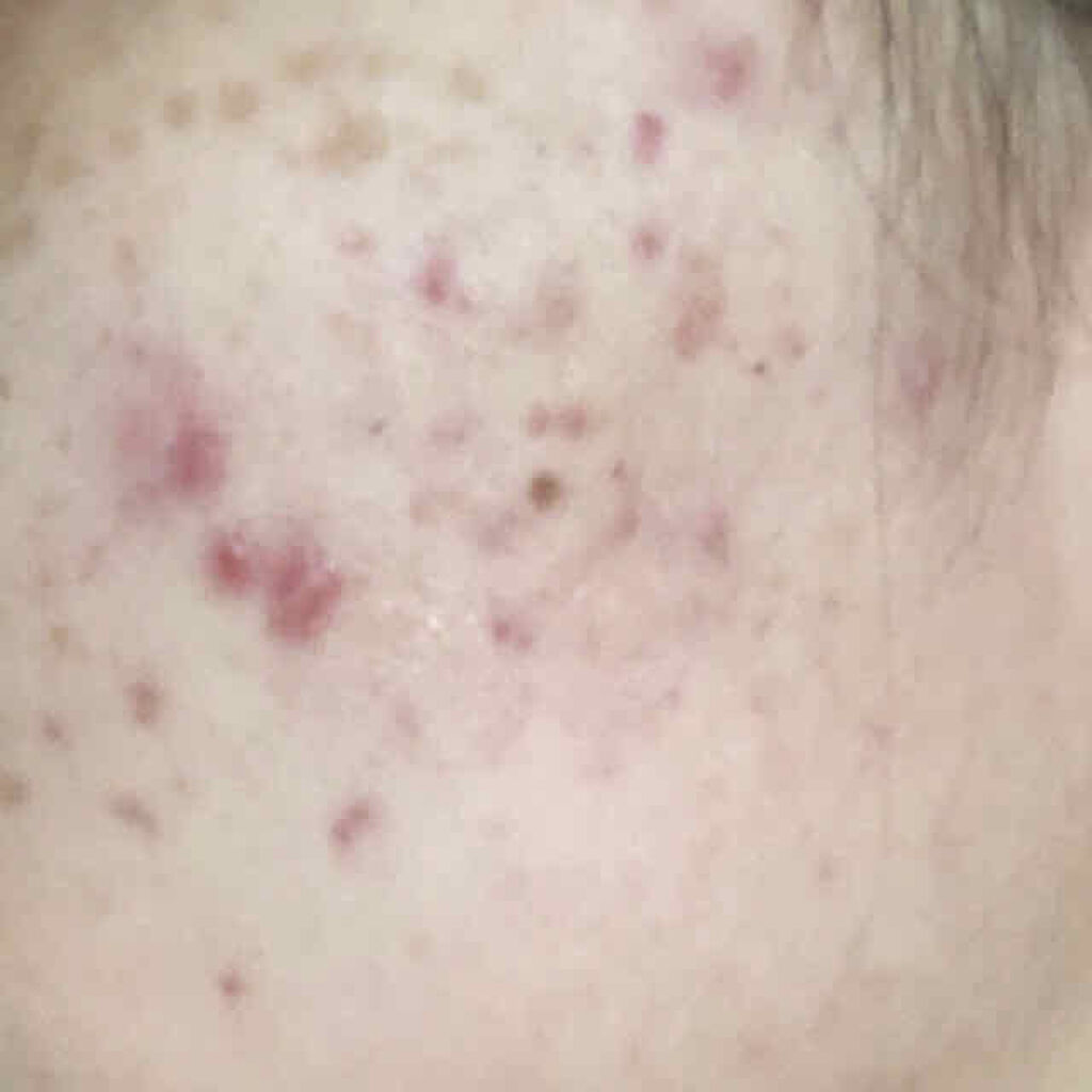 キールズ DS クリアリーブライト エッセンス[医薬部外品]/Kiehl's/美容液を使ったクチコミ（2枚目）