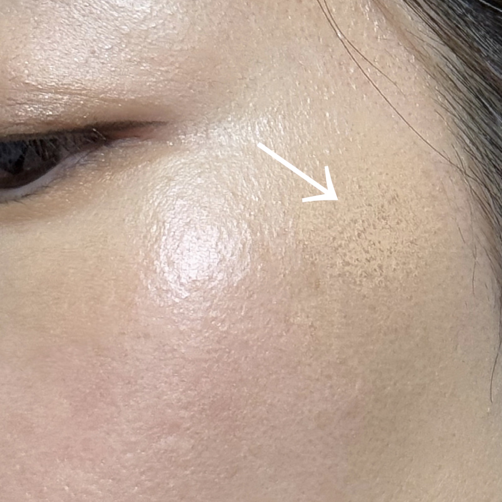 リアル フローレス ウェイトレス パーフェクティング コンシーラー/ローラ メルシエ/リキッドコンシーラーを使ったクチコミ（2枚目）