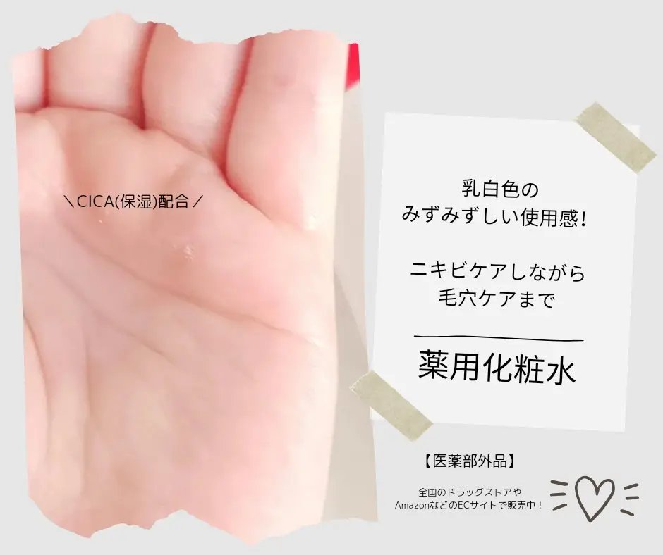 薬用泡のふんわり洗顔/スキンライフ/泡洗顔を使ったクチコミ（2枚目）