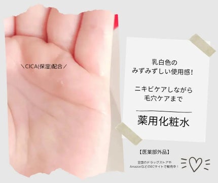 薬用泡のふんわり洗顔/スキンライフ/泡洗顔を使ったクチコミ(2枚目)