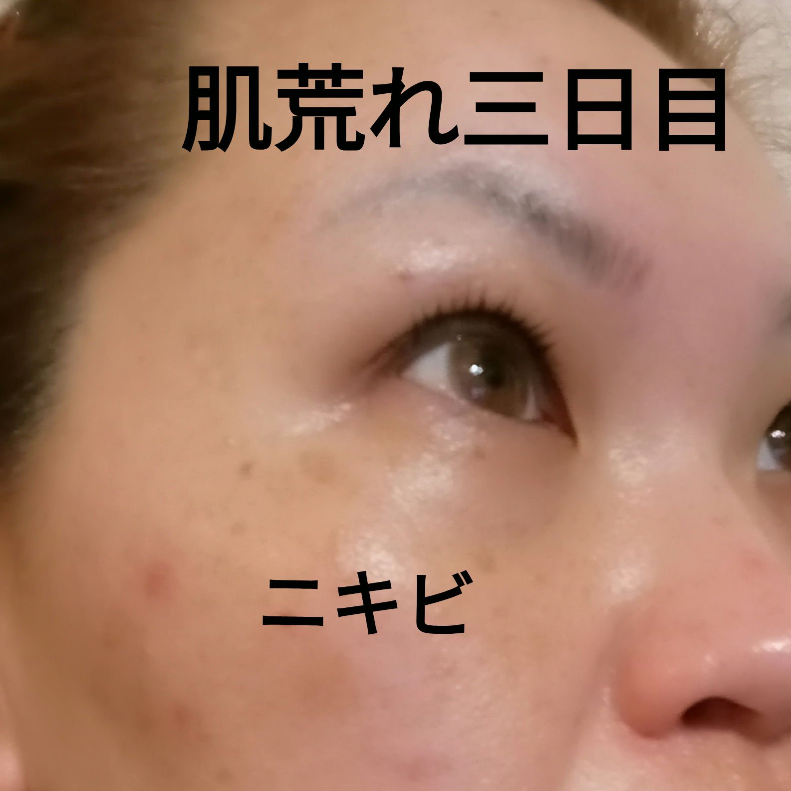 ナチュラルパック /MIRANAL/洗い流すパック・マスクを使ったクチコミ（1枚目）