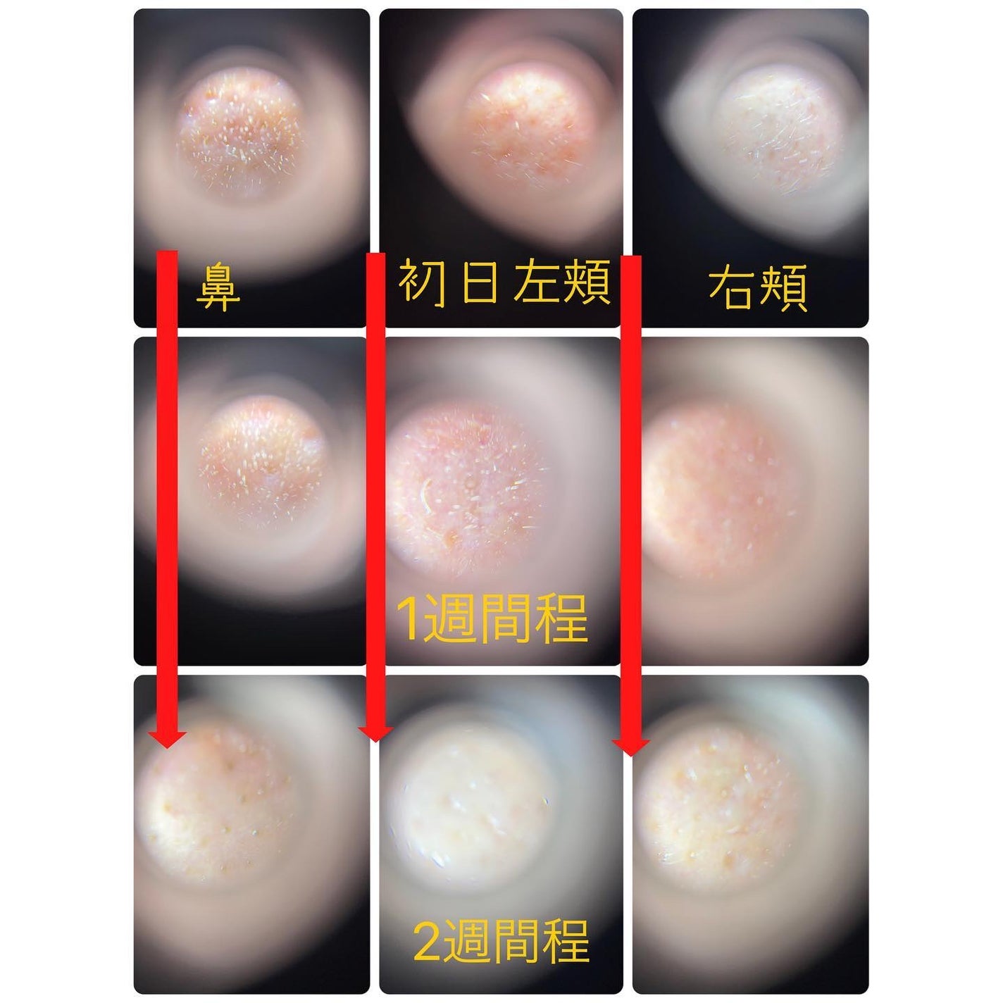リードルショット300/VT/美容液を使ったクチコミ(3枚目)