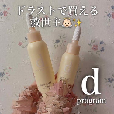 アクネケア ローション MB/d プログラム/化粧水を使ったクチコミ（1枚目）