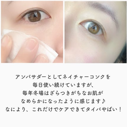 ネイチャーコンク 薬用クリアローション/ネイチャーコンク/拭き取り化粧水を使ったクチコミ(6枚目)