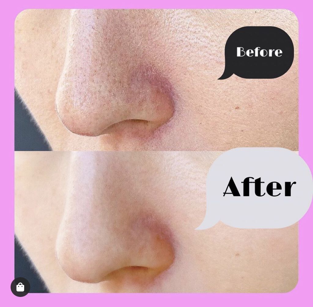 アクアフューチャースキン/アクアフューチャースキン/美顔器・マッサージを使ったクチコミ(4枚目)