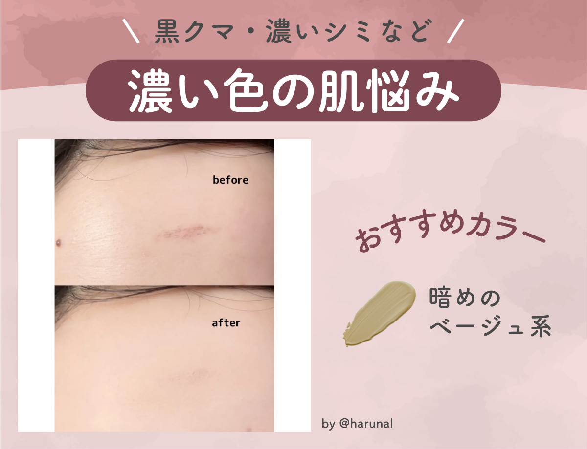 黒クマ・濃いシミなど濃い色の肌悩みには暗めのベージュ系がおすすめ。