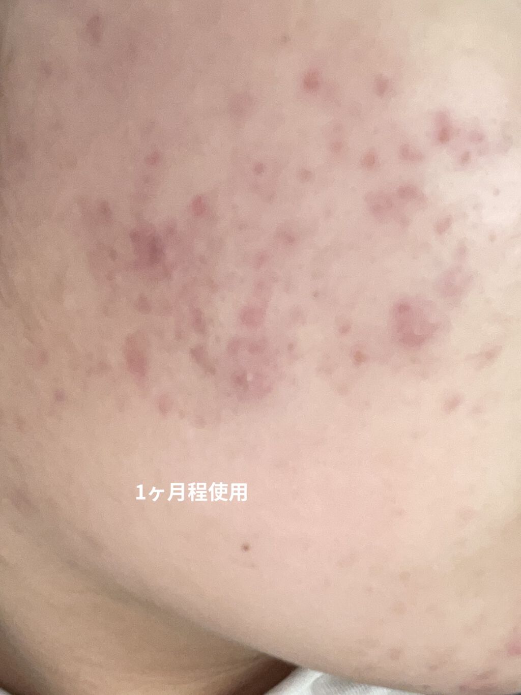 ドクダミ 77 スージングトナー/Anua/化粧水を使ったクチコミ（3枚目）