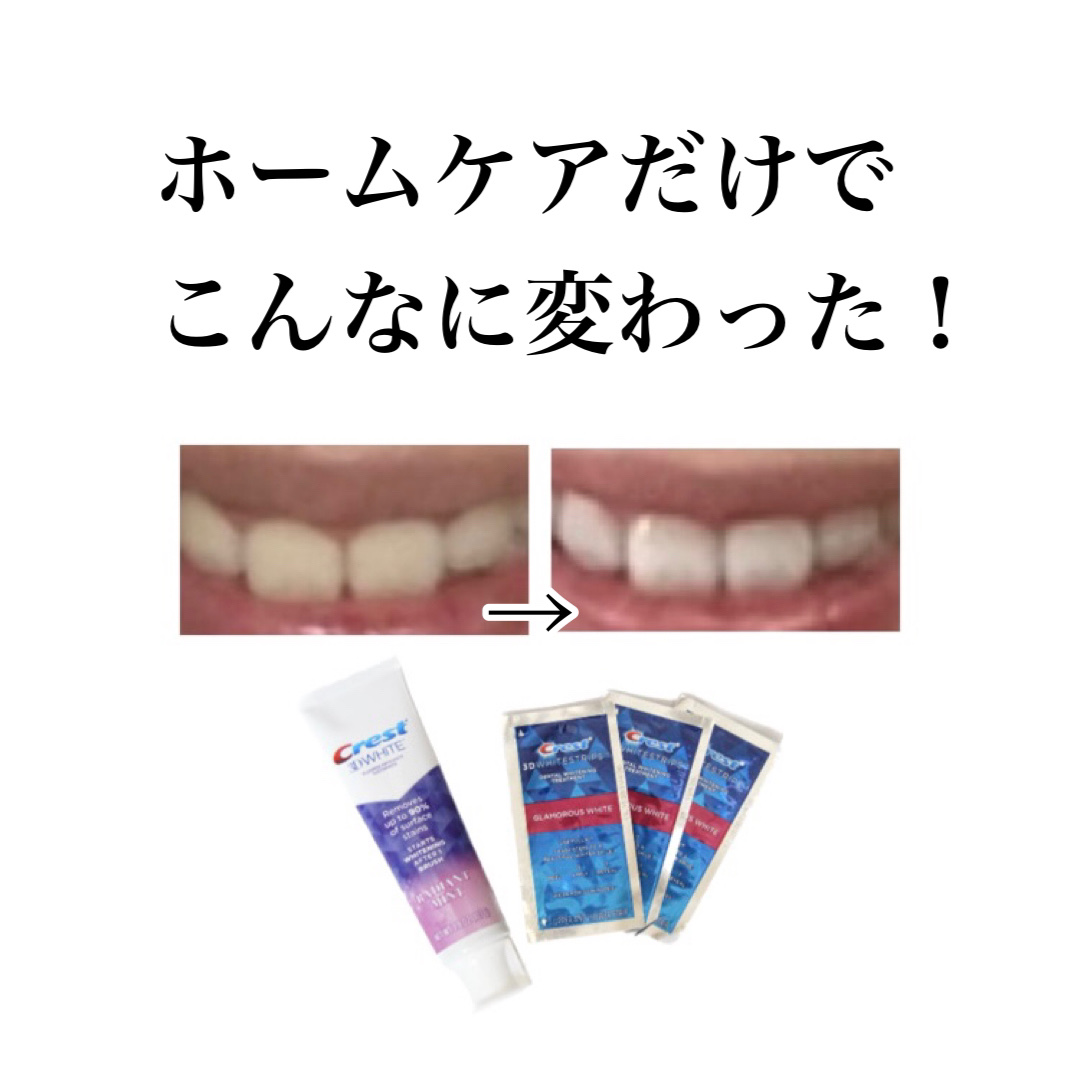 Crest 3D ホワイト/クレスト/歯磨き粉を使ったクチコミ（1枚目）