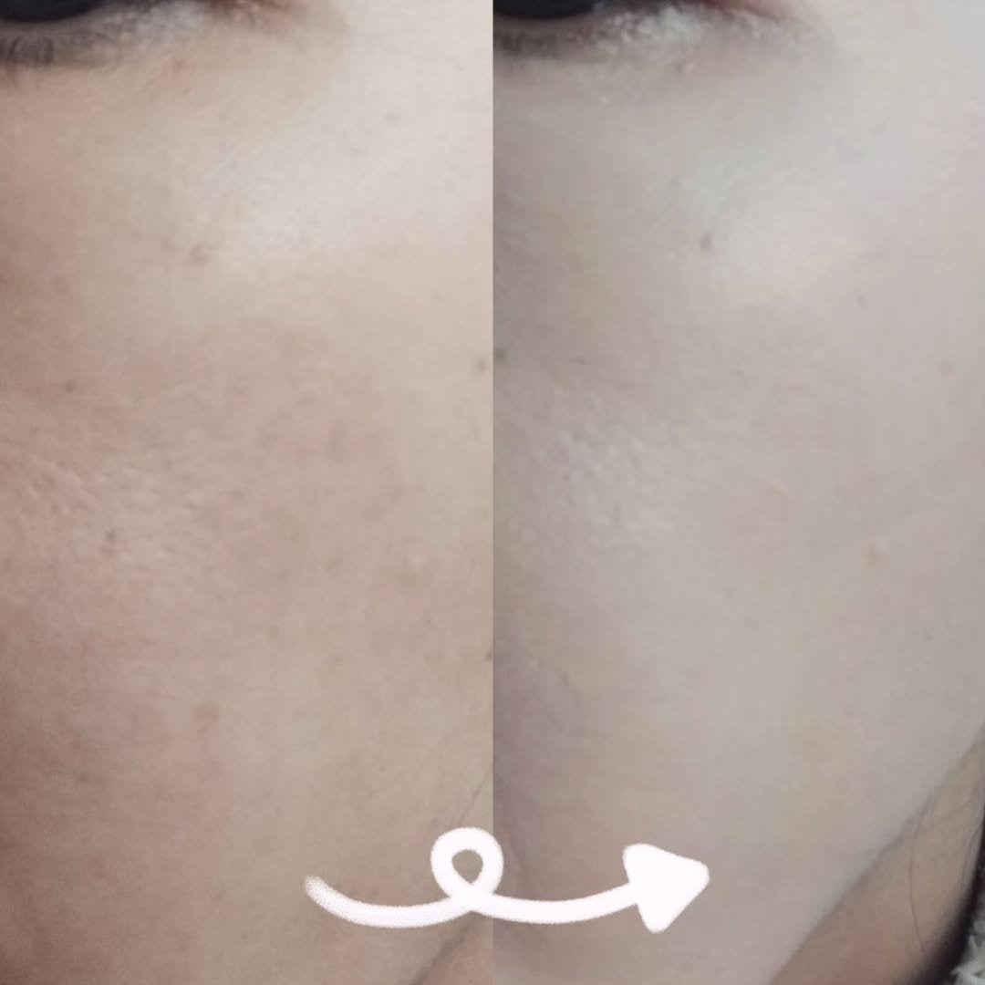 ブラーカバークッション/LUNA/クッションファンデーションを使ったクチコミ(5枚目)