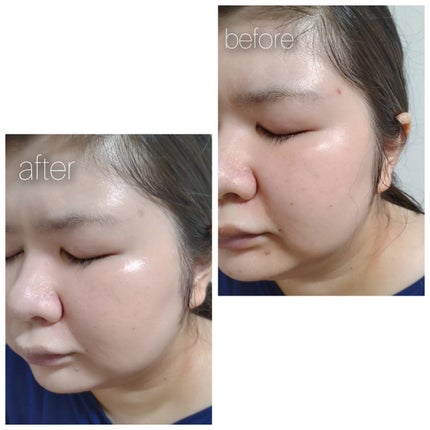 プレミアムニードルファンデーション/ジュエリアプレミアム/クッションファンデーションを使ったクチコミ(10枚目)