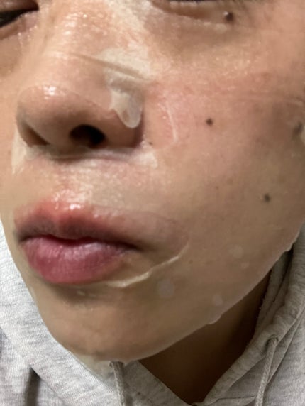 ビタタイガーマスク/NOWATER/シートマスク・パックを使ったクチコミ(5枚目)