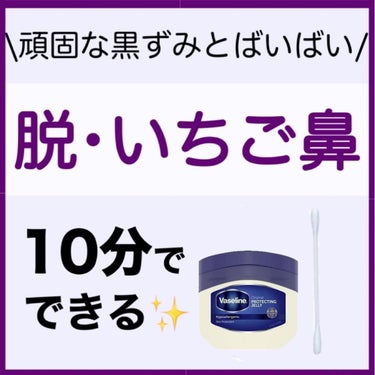 みなさんが悩んでいるその頑固な黒ずみ、解決します✨✨







今回は私の黒ずみ対処法について説明します！










今はコロナ禍でマスクをつけているため

そこまで目立ちませんが

やっ