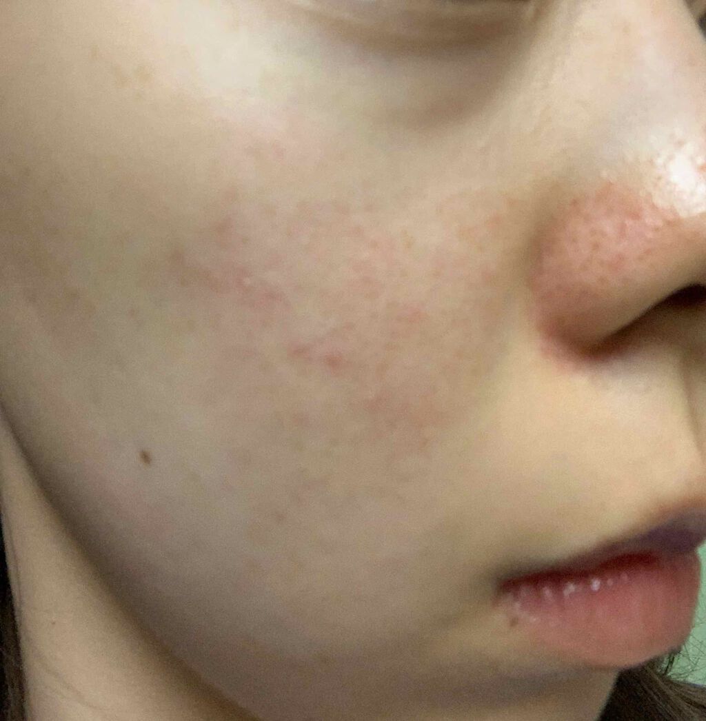 つき on LIPS 「コロナ自粛で、1ヶ月、人に会う予定がないので肌断食してみる。い..」(2枚目)