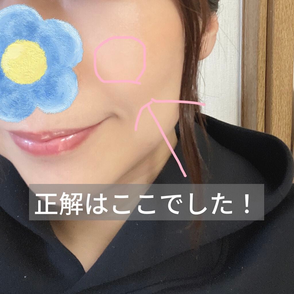 プロCICA クリアスポットパッチ/VT/その他スキンケアを使ったクチコミ(2枚目)