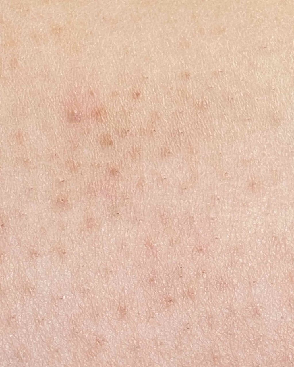 フェリエ フェイス用 ES-WF40/Panasonic/シェーバーを使ったクチコミ（3枚目）