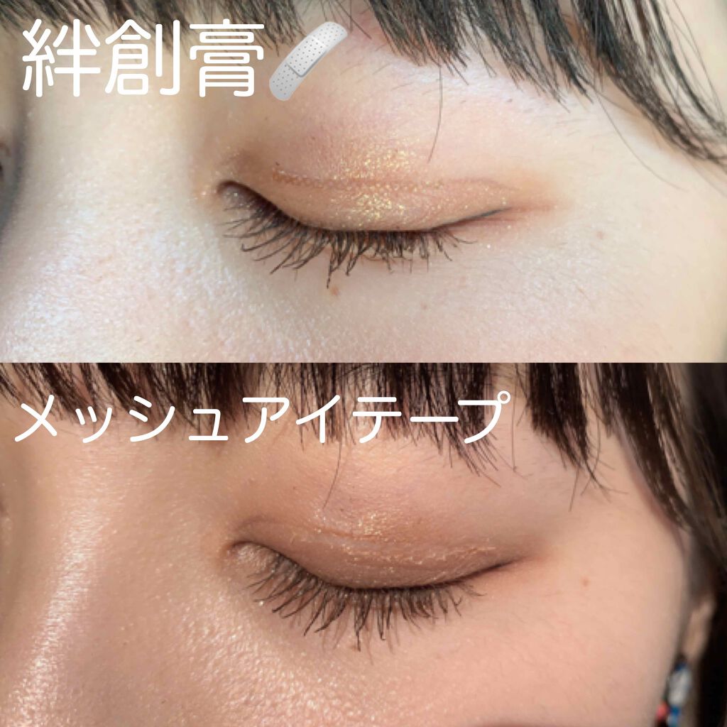 肌色タイプ/バンドエイド/その他を使ったクチコミ（2枚目）