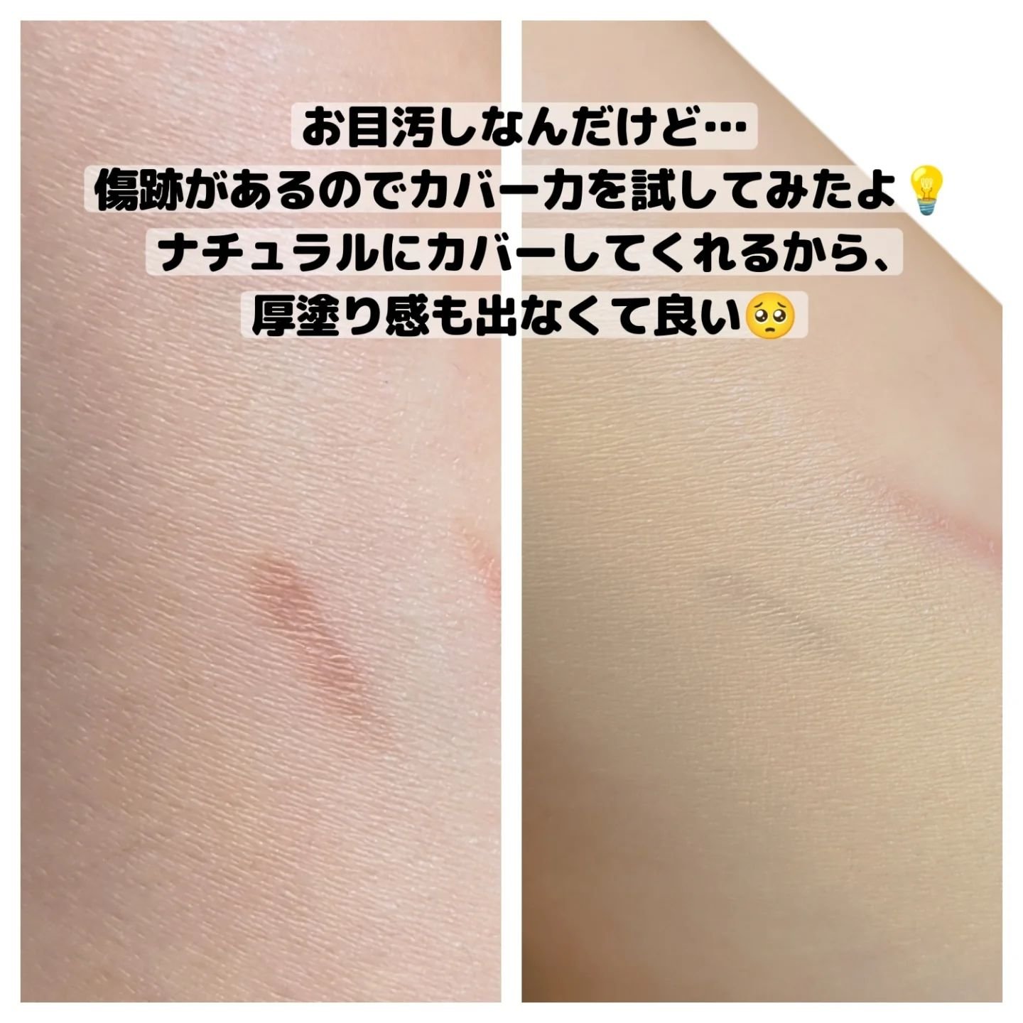 ダーマシンコンシーラー 2号 ナチュラルベージュ/23years old/リキッドコンシーラーを使ったクチコミ（3枚目）