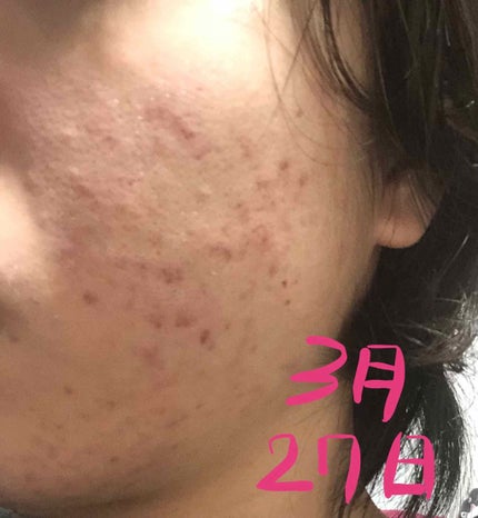 化粧水・敏感肌用・しっとりタイプ/無印良品/化粧水を使ったクチコミ(4枚目)