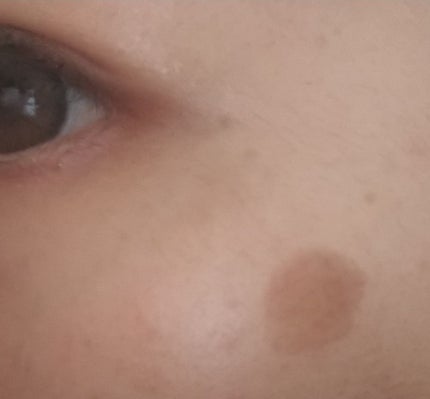 メラノフォーカスV/HAKU/美容液を使ったクチコミ(3枚目)