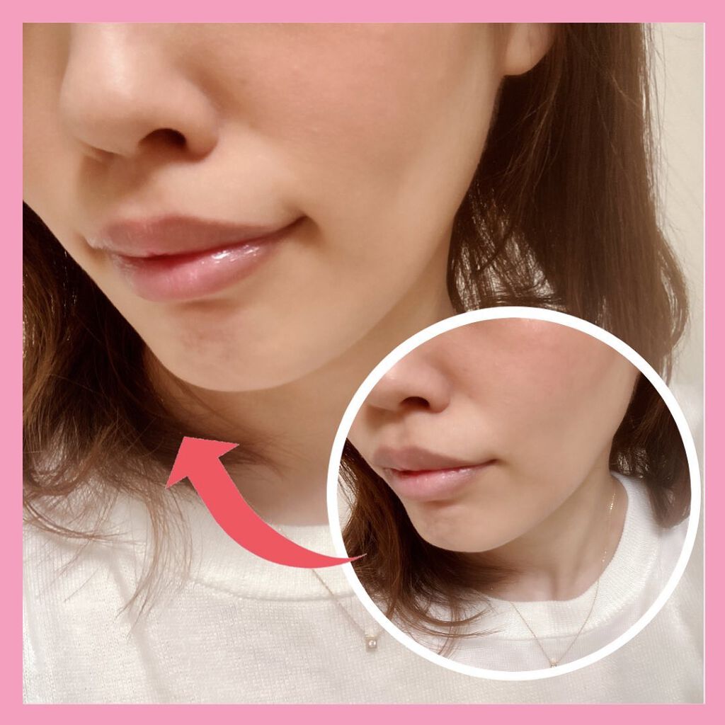 朝可愛グロス/Fujiko/リップグロスを使ったクチコミ(2枚目)