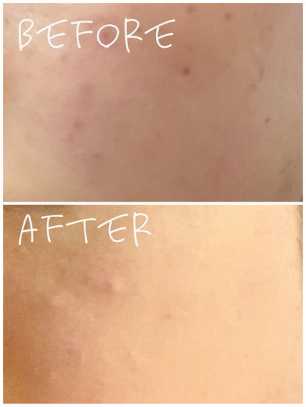 スポッツカバー ファウンデイション/SHISEIDO/クリームコンシーラーを使ったクチコミ(2枚目)