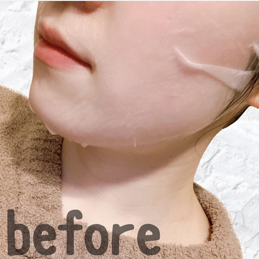 バイオームビタCグローデイリーシートマスク/UIQ/シートマスク・パックを使ったクチコミ（3枚目）