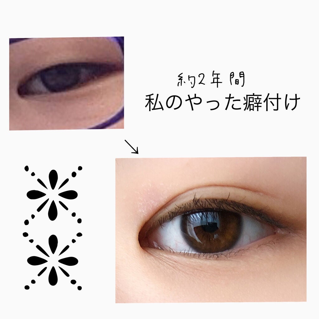 アイトーク/アイトーク/二重まぶた用アイテムを使ったクチコミ(1枚目)