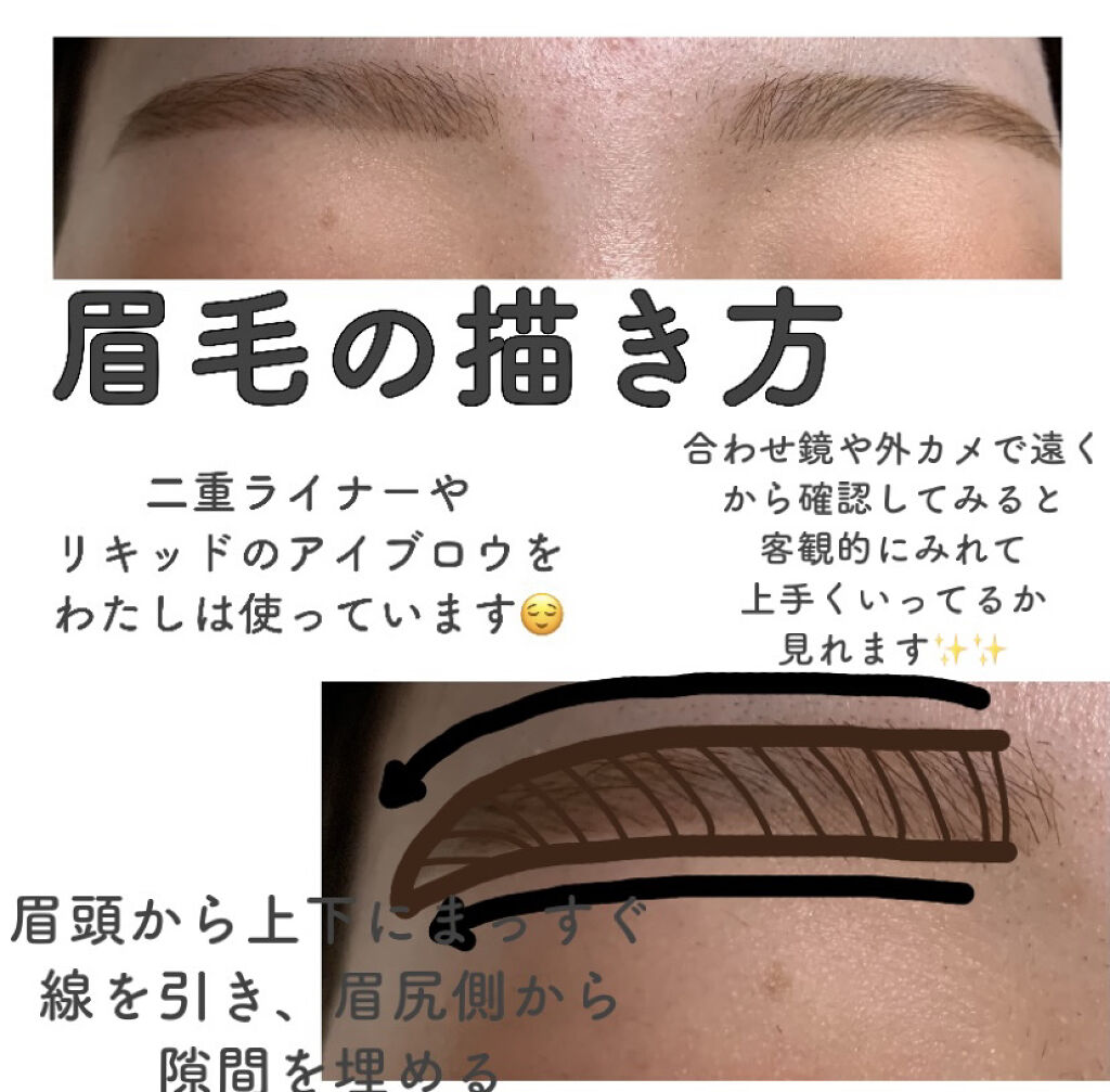 プレミア敏感肌用 Lディスポ/シック/シェーバーを使ったクチコミ（3枚目）