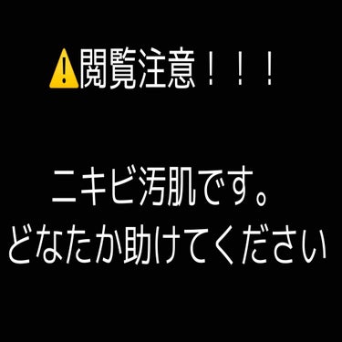 ETUDE AC クリーンアップ トナーのクチコミ「ニキビが治りません…。
助けてください…。

私今高2なんですけど、小4からニキビができ始めて.....」（1枚目）