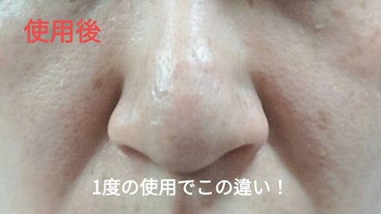 角質スッキリ毛穴パック /HANYUL(ハンユル)/洗い流すパック・マスクを使ったクチコミ(4枚目)