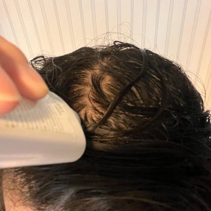 オンリーユースカルプセラム/hoLy_One/頭皮ローションを使ったクチコミ(2枚目)