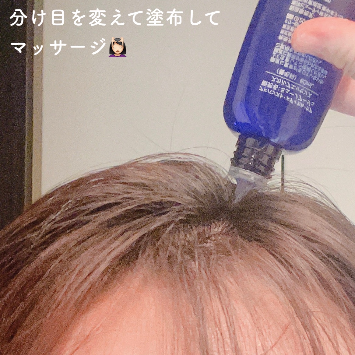 Wアプローチヘアプログラム/MUNOAGE(ミューノアージュ)/頭皮ローションを使ったクチコミ（3枚目）