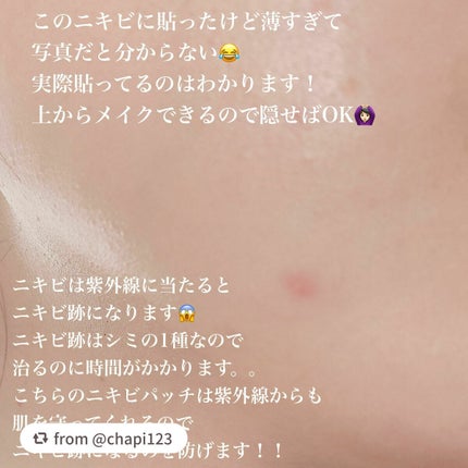 ティーツリーカーミングスポットパッチ/MEDIHEAL/その他スキンケアを使ったクチコミ(3枚目)