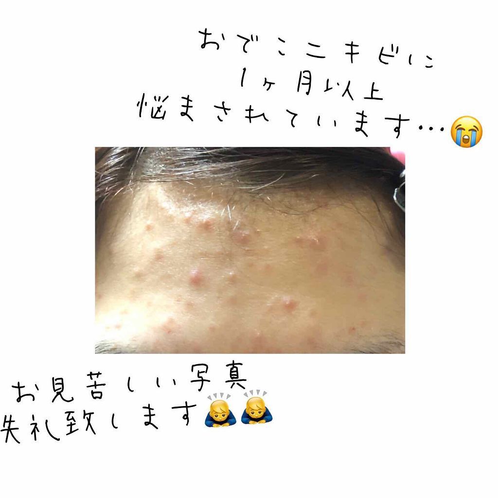 明色美顔水 薬用化粧水/美顔/化粧水を使ったクチコミ(2枚目)