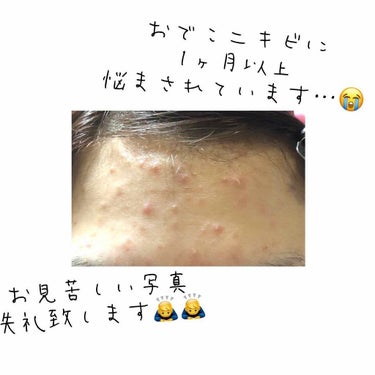 明色 美顔水 薬用化粧水/美顔/化粧水を使ったクチコミ（2枚目）