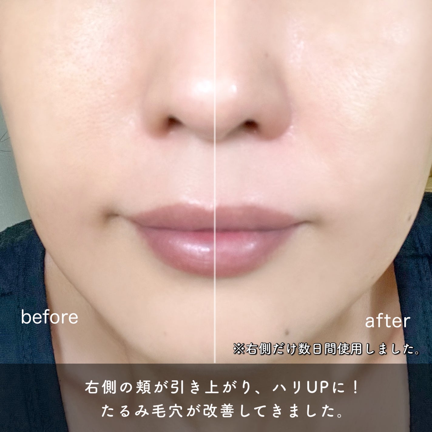 ポアタイトニングブーストセラム/CELORABY/美容液を使ったクチコミ(6枚目)